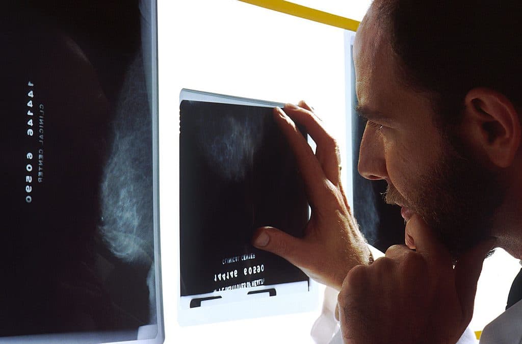 Why You May Need a Medical Malpractice Lawyer