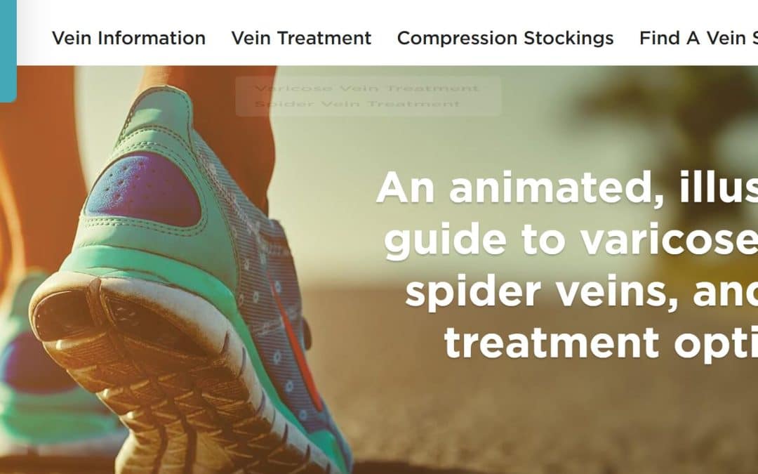 6 Expert-Approved Solutions For Varicose Veins